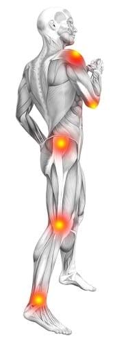 compensation calculator for injuries to the human body